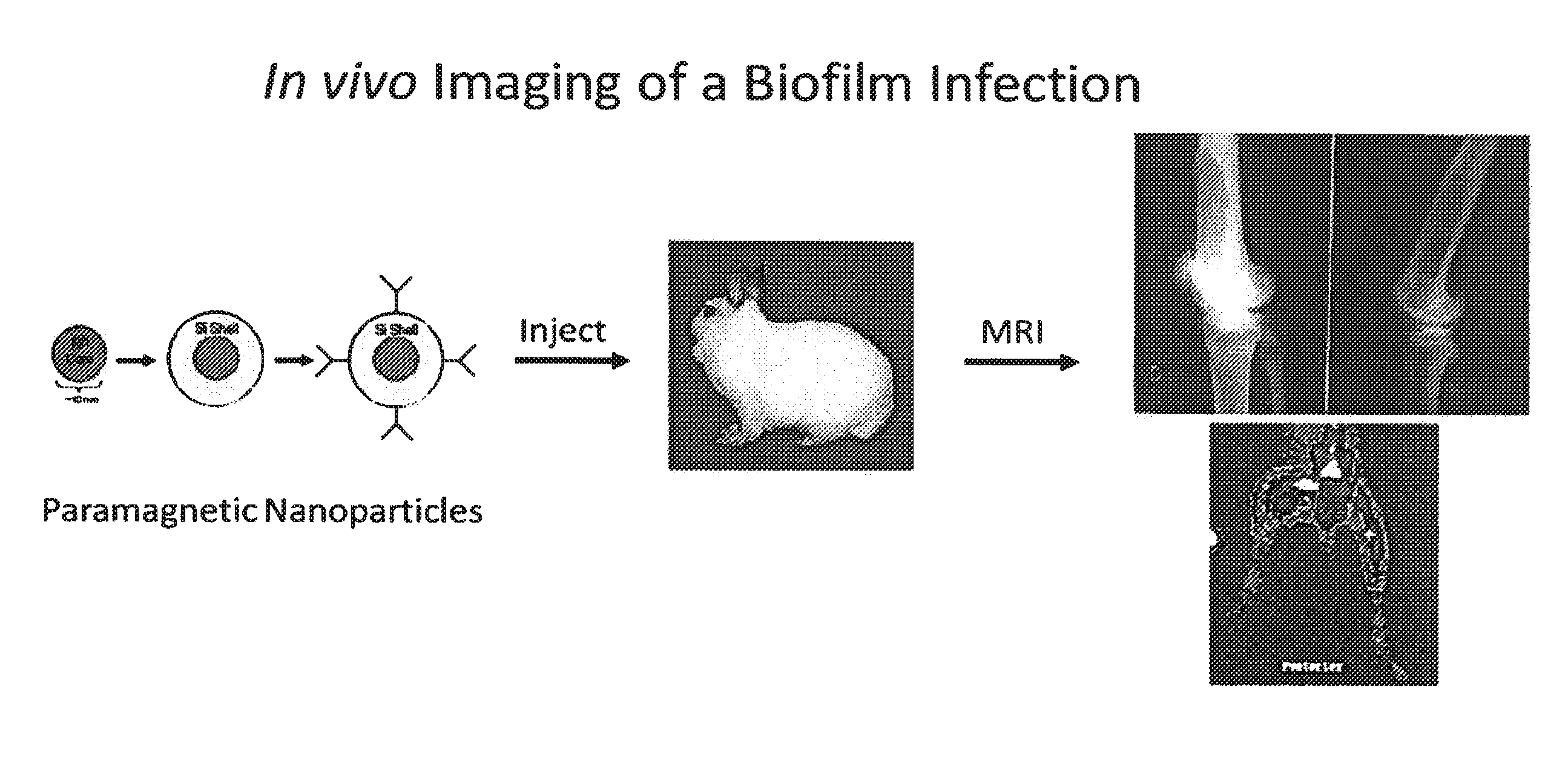 In vivo biofilm infection diagnosis and treatment