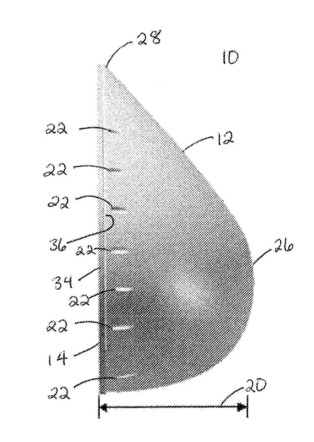 Breast Reconstruction Device And Methods