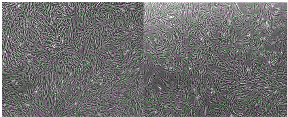 Clinical-grade placenta mesenchymal stem cell preparation method