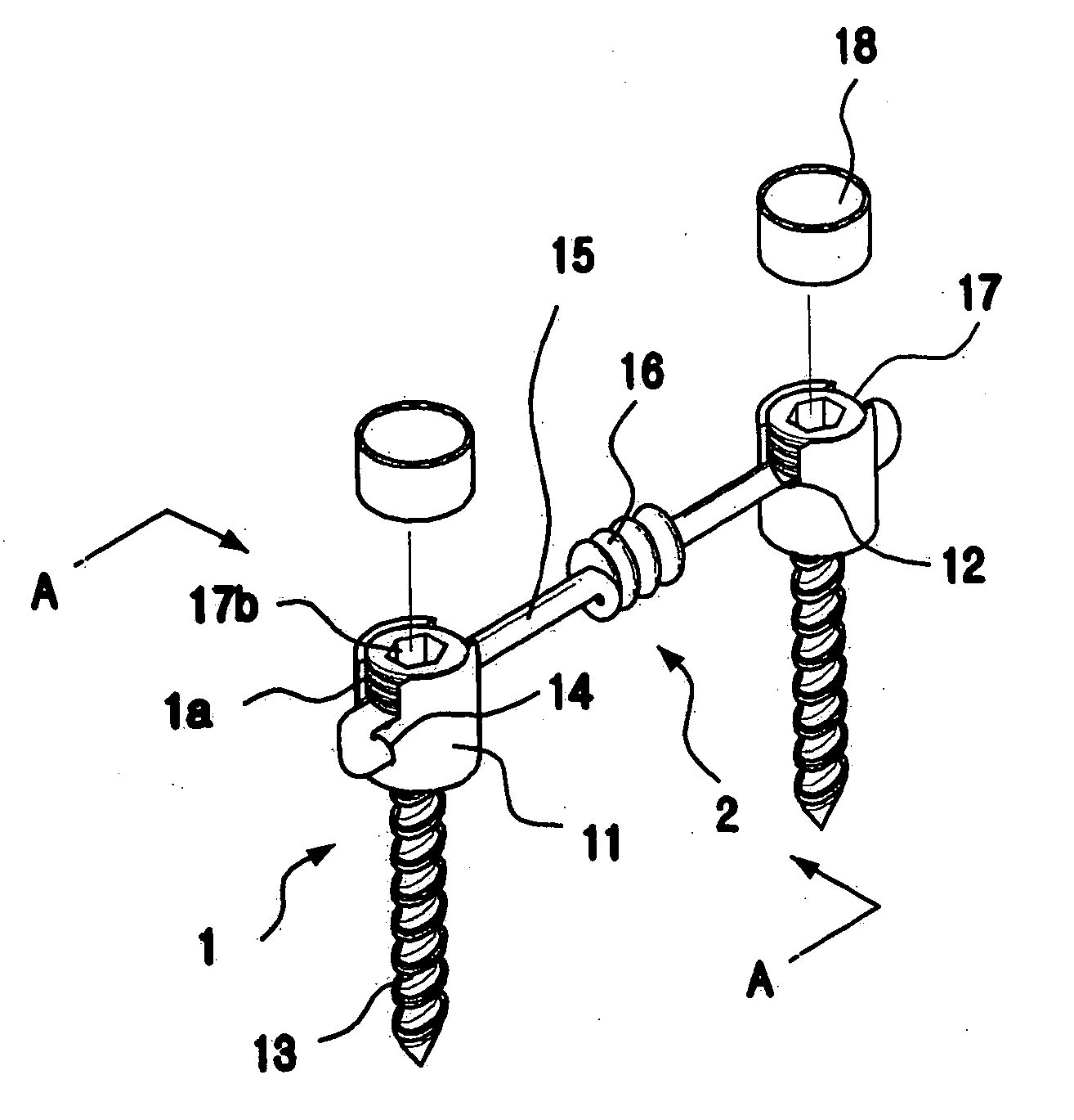 Bio-flexible spinal fixation apparatus with shape memory alloy