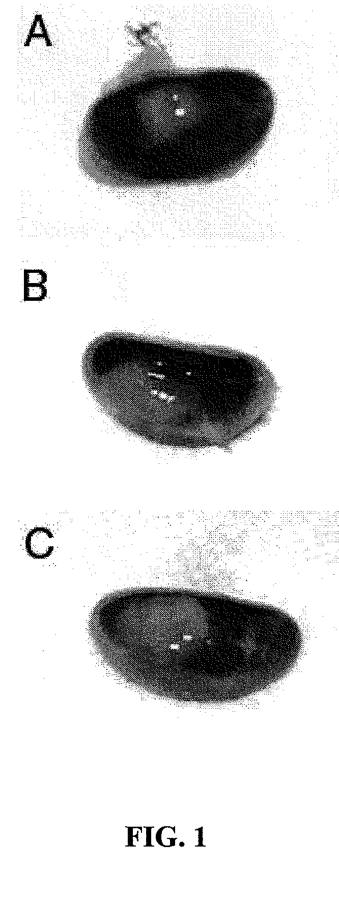 Compositions containing sertoli cells and myoid cells and use thereof in cellular transplants