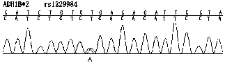 Primer and method for detecting ADH1B gene*2 polymorphism