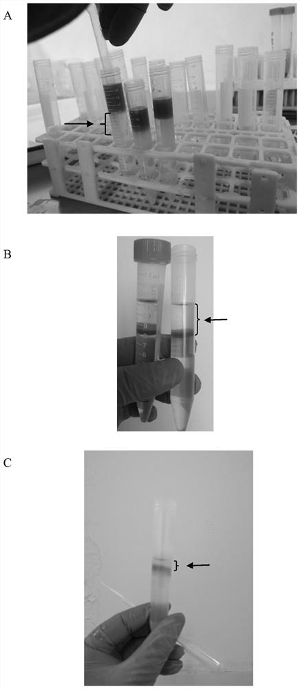 Method for separating echinococcus granulosus eggs from dog manure and hatching oncosphere in vitro for primary infection animal modeling