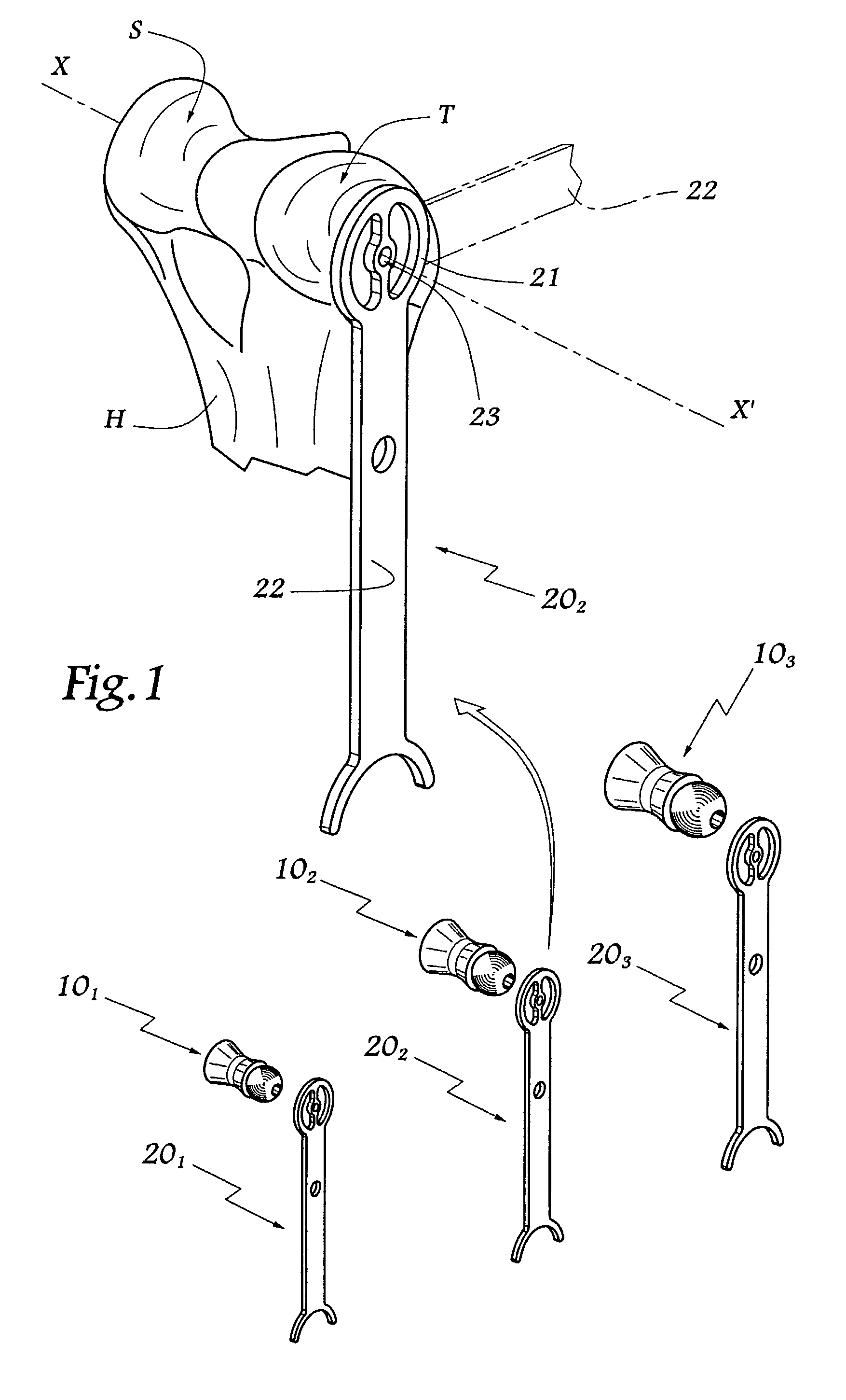 Ancillary tool for fitting a humeral component of an elbow prosthesis