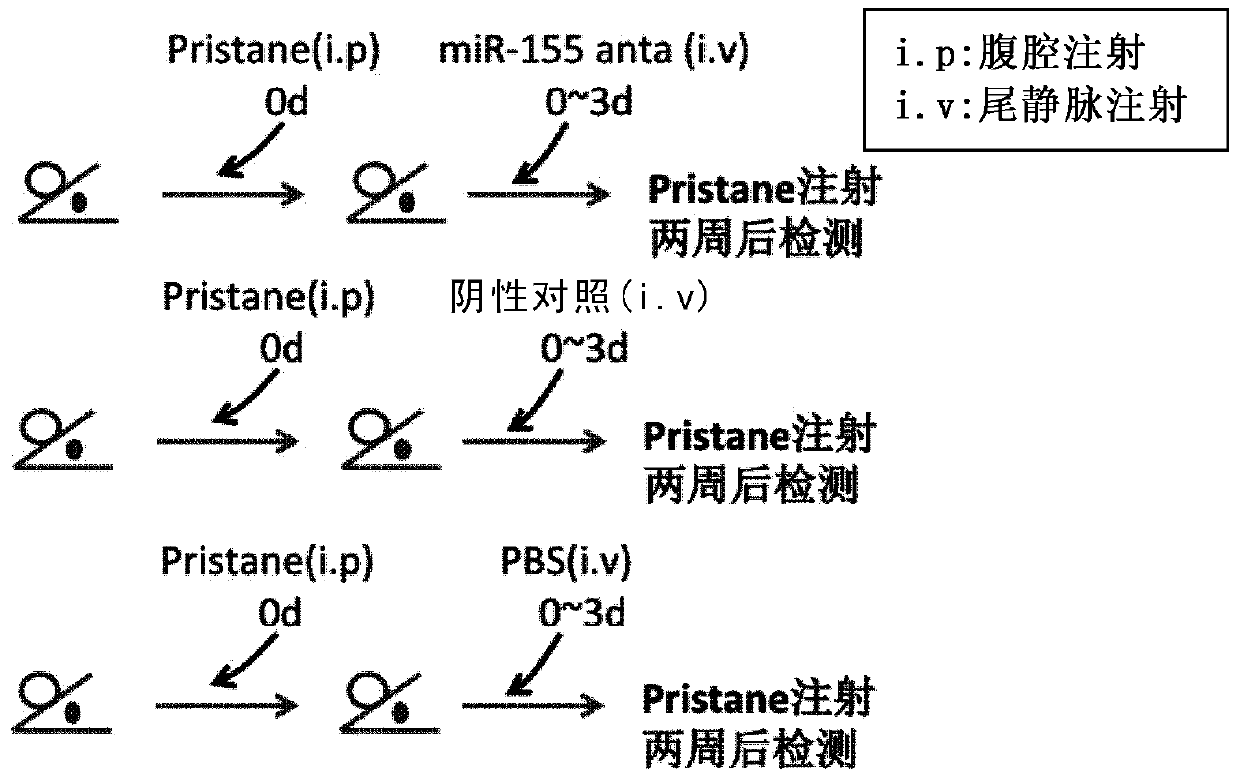 Use of mir-155 in the preparation of medicines for preventing and treating acute lung injury