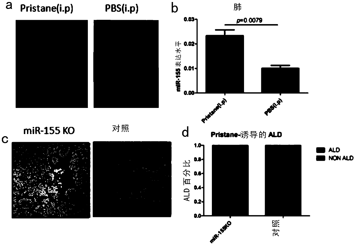 Use of mir-155 in the preparation of medicines for preventing and treating acute lung injury