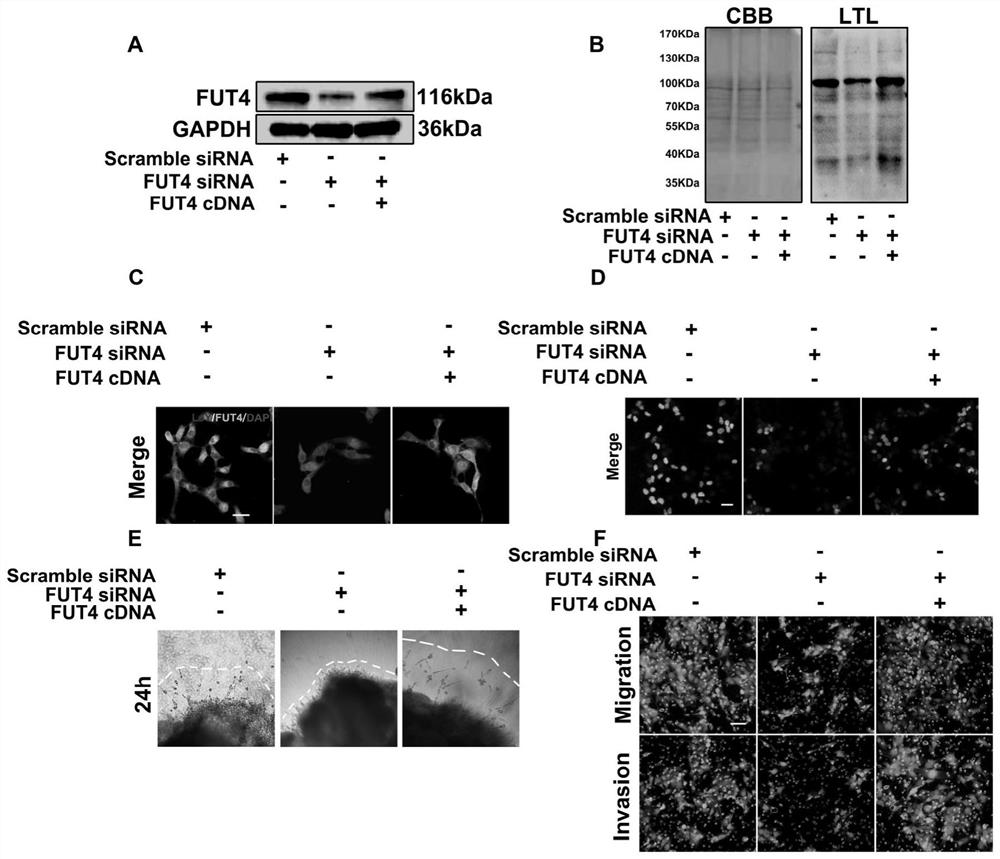 Biomarker for auxiliary diagnosis of recurrent abortion, and application thereof