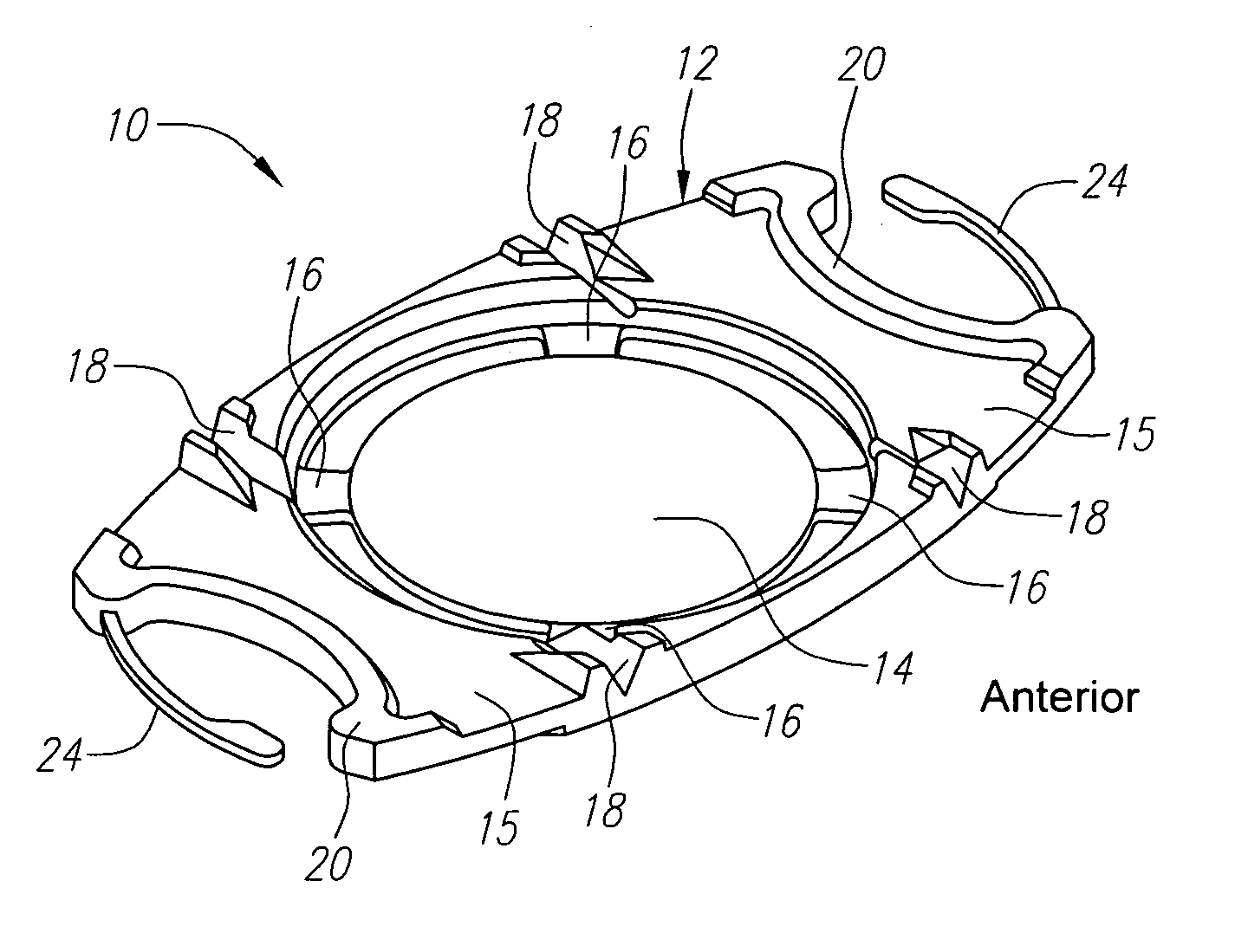 Floating optic accommodating intraocular lens