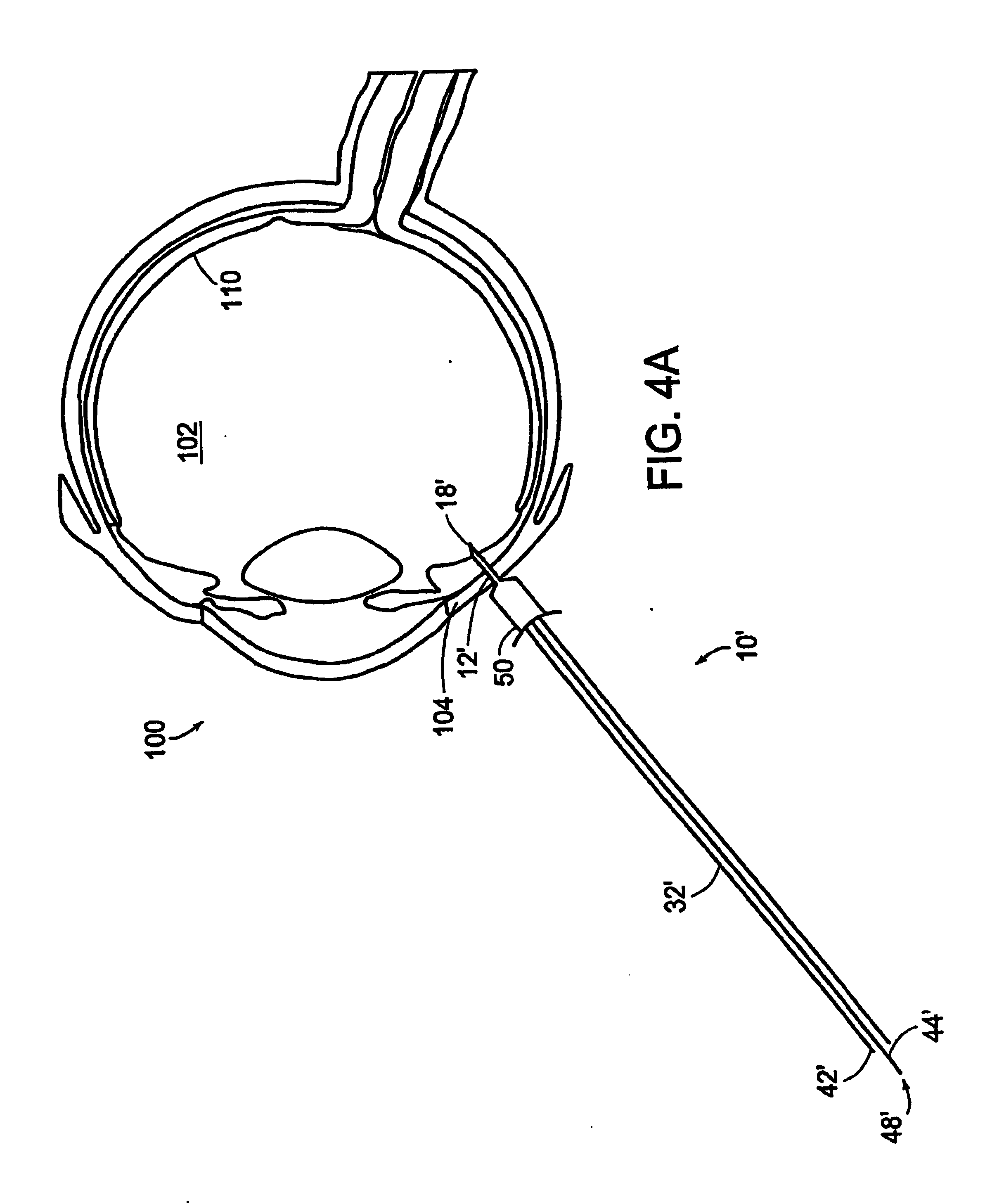 Method for subretinal administration of therapeutics including steroids; method for localizing pharmacodynamic action at the choroid of the retina; and related methods for treatment and/or prevention of retinal diseases