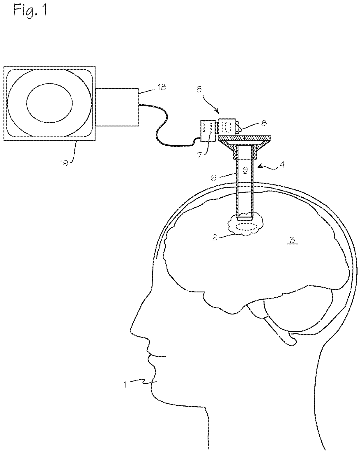 Fluorescence imaging system