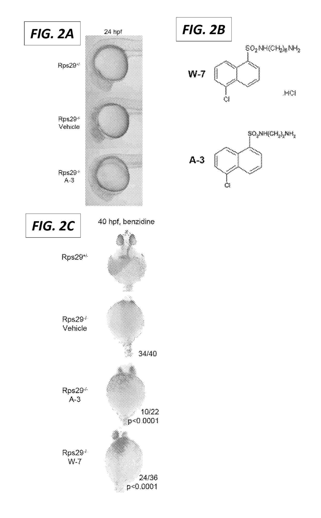 Calmodulin inhibitors for the treatment of ribosomal disorders and ribosomapathies