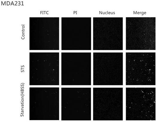 Apoptosis Detection Method and Apoptosis Detection Kit