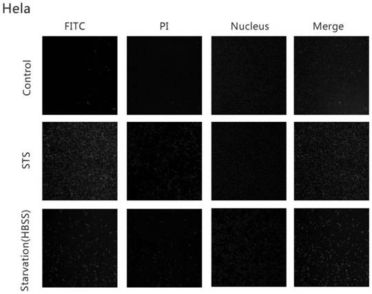 Apoptosis Detection Method and Apoptosis Detection Kit