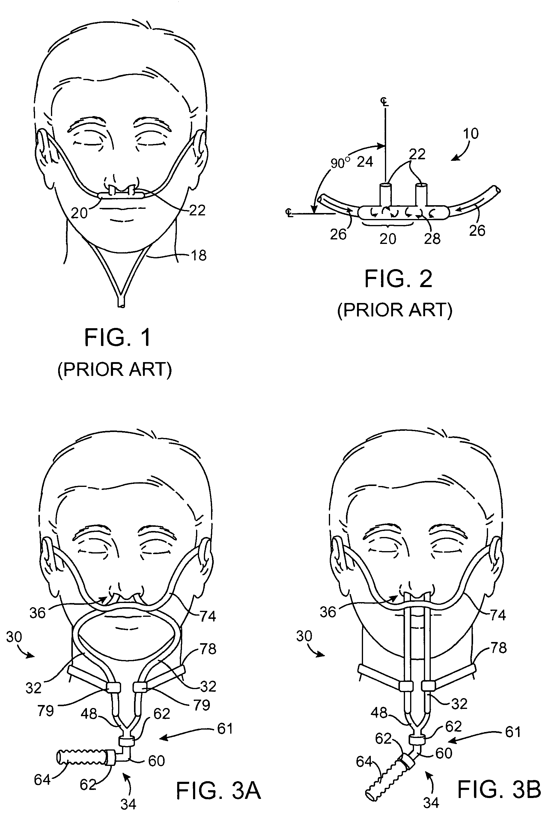 Method and device for non-invasive ventilation with nasal interface