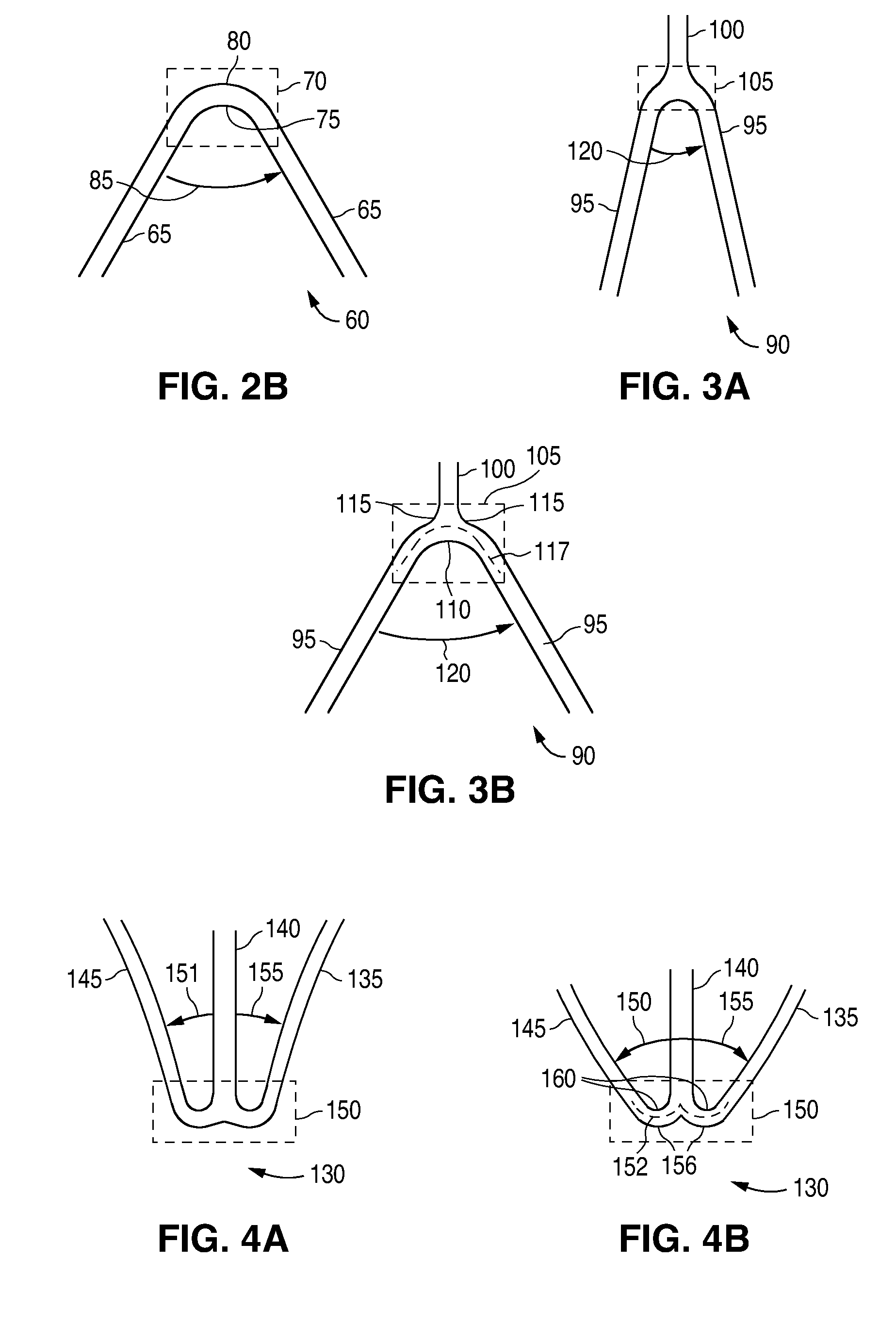 Method of making a medical device with regioselective structure-property distribution