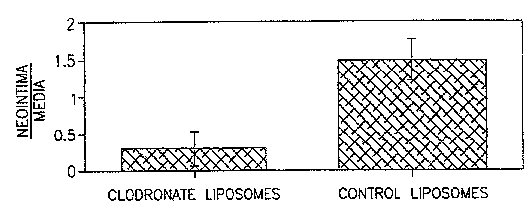 Method of inhibiting restenosis using bisphosphonates