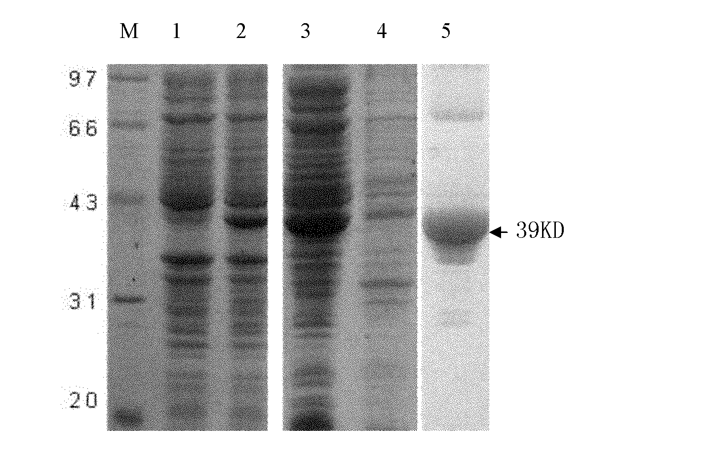 Japanese blood fluke protein and application thereof