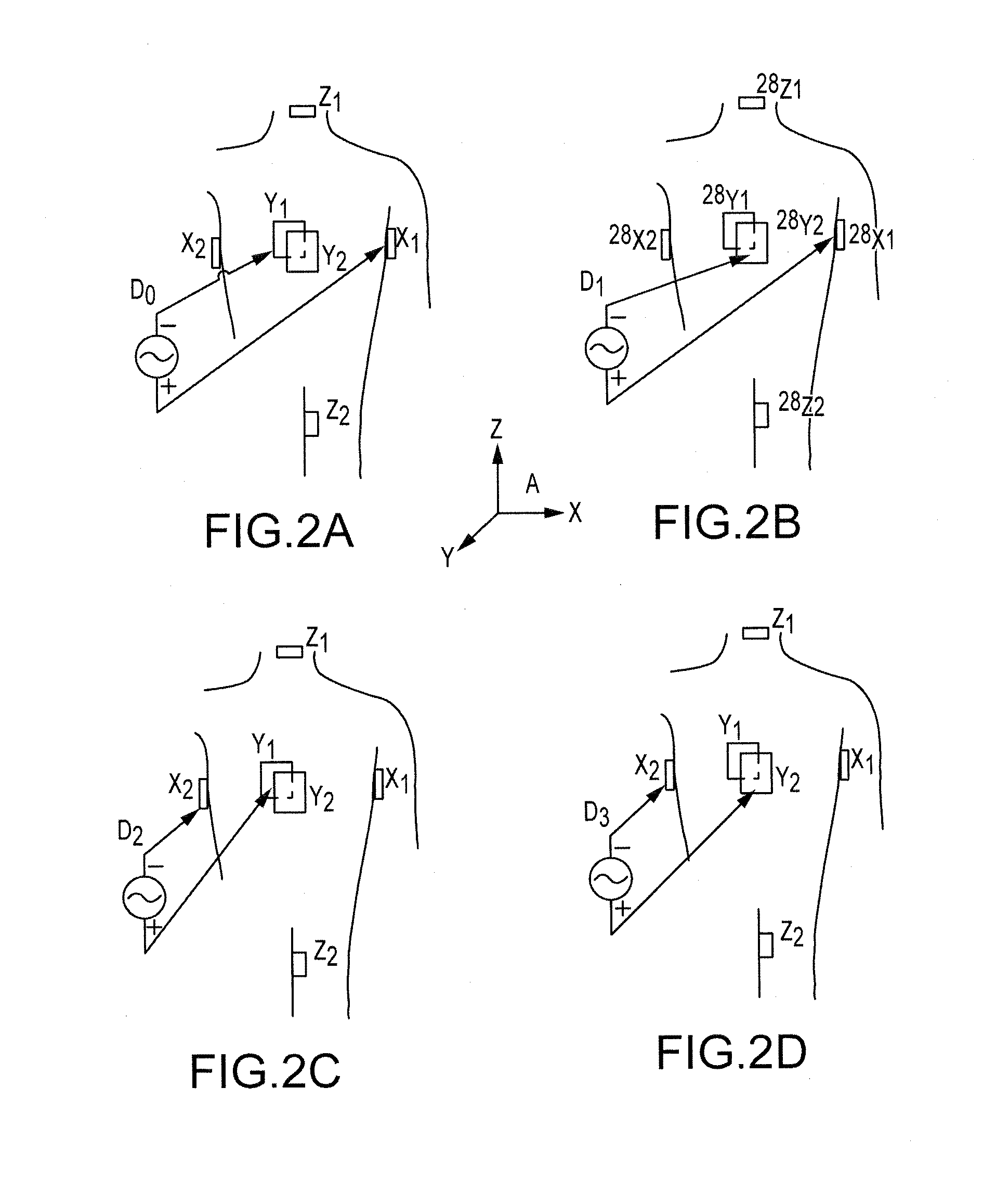 Scaling of electrical impedance-based navigation space using inter-electrode spacing