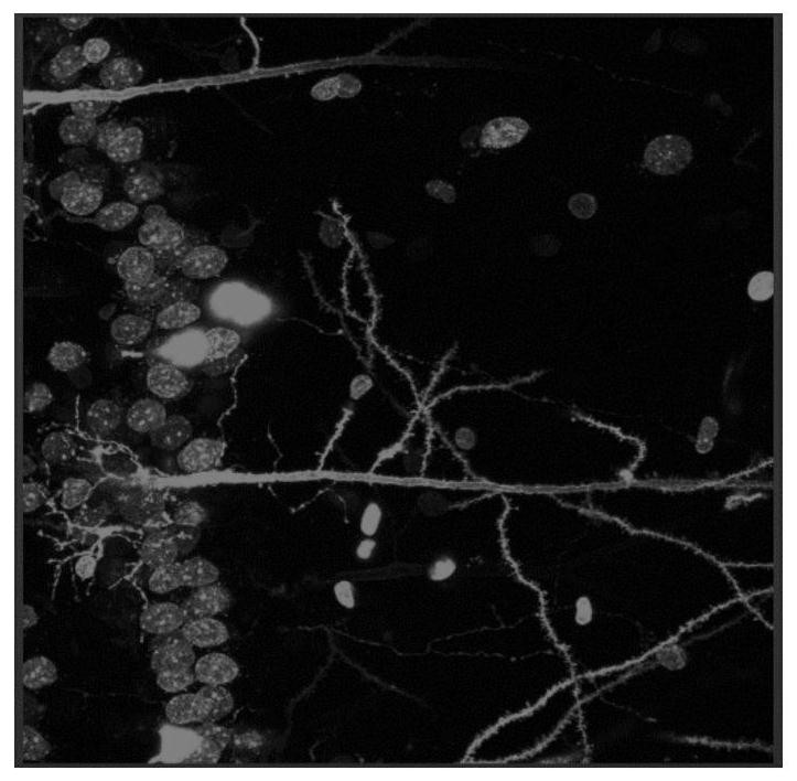 Method for detecting form of neuron dendritic spine in brain slice