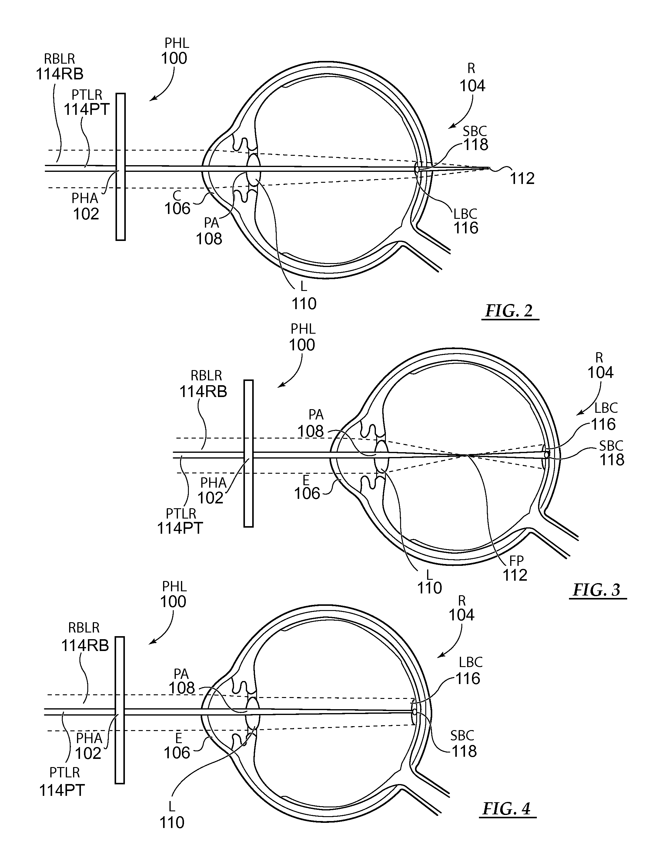 Pinhole Glasses