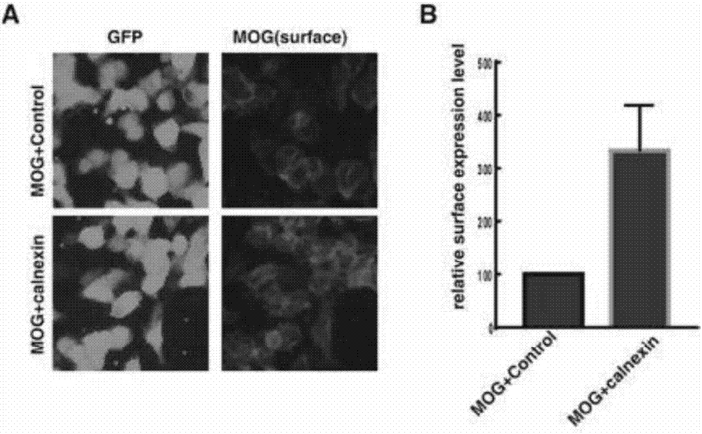 Detection method of human myelin oligodendroglia glycoprotein self immune antibody