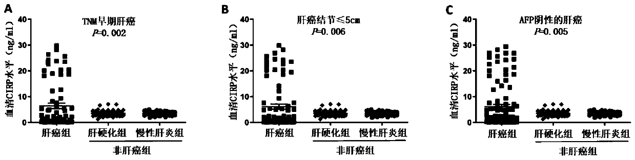 Tumor marker serum cold-inducible RNA-binding protein for liver cancer and application thereof