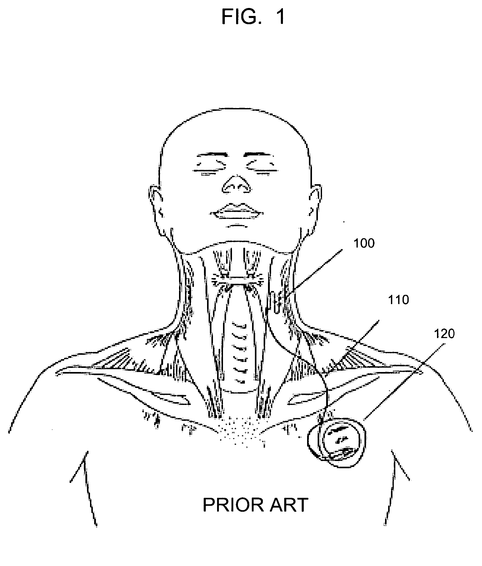 Device for neuromuscular peripheral body stimulation and electrical stimulation (ES) for wound healing using RF energy harvesting