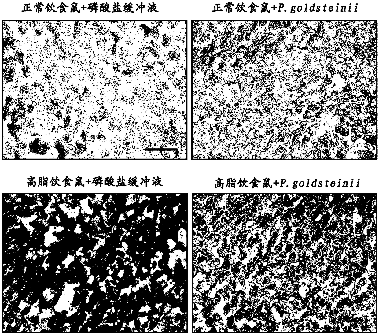 Use of parabacteroides goldsteinii to treat fatty liver disease