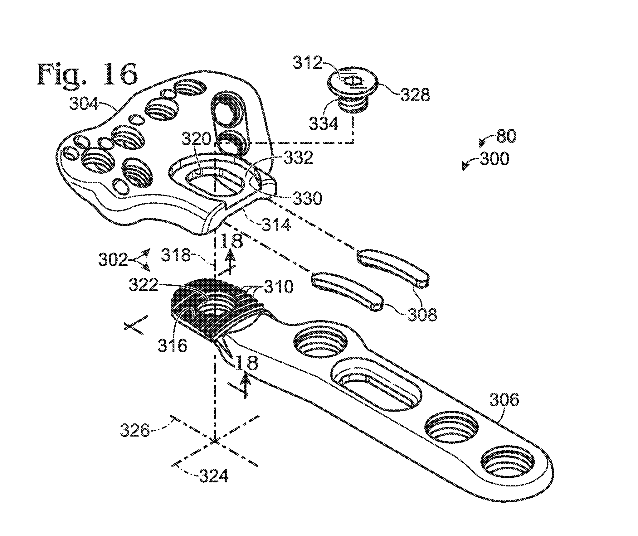 Bone plate with movable joint