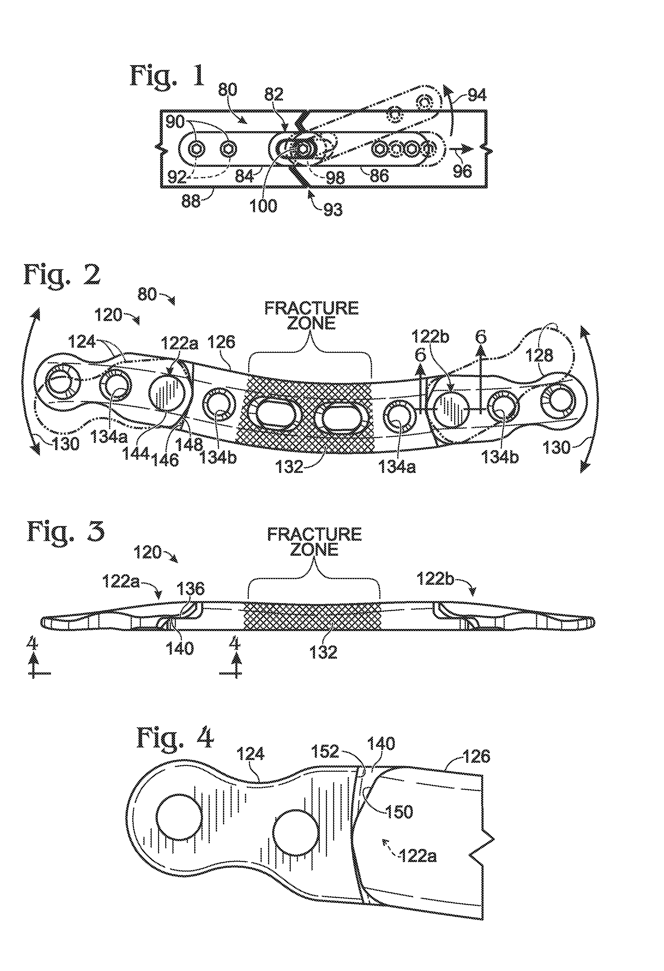 Bone plate with movable joint