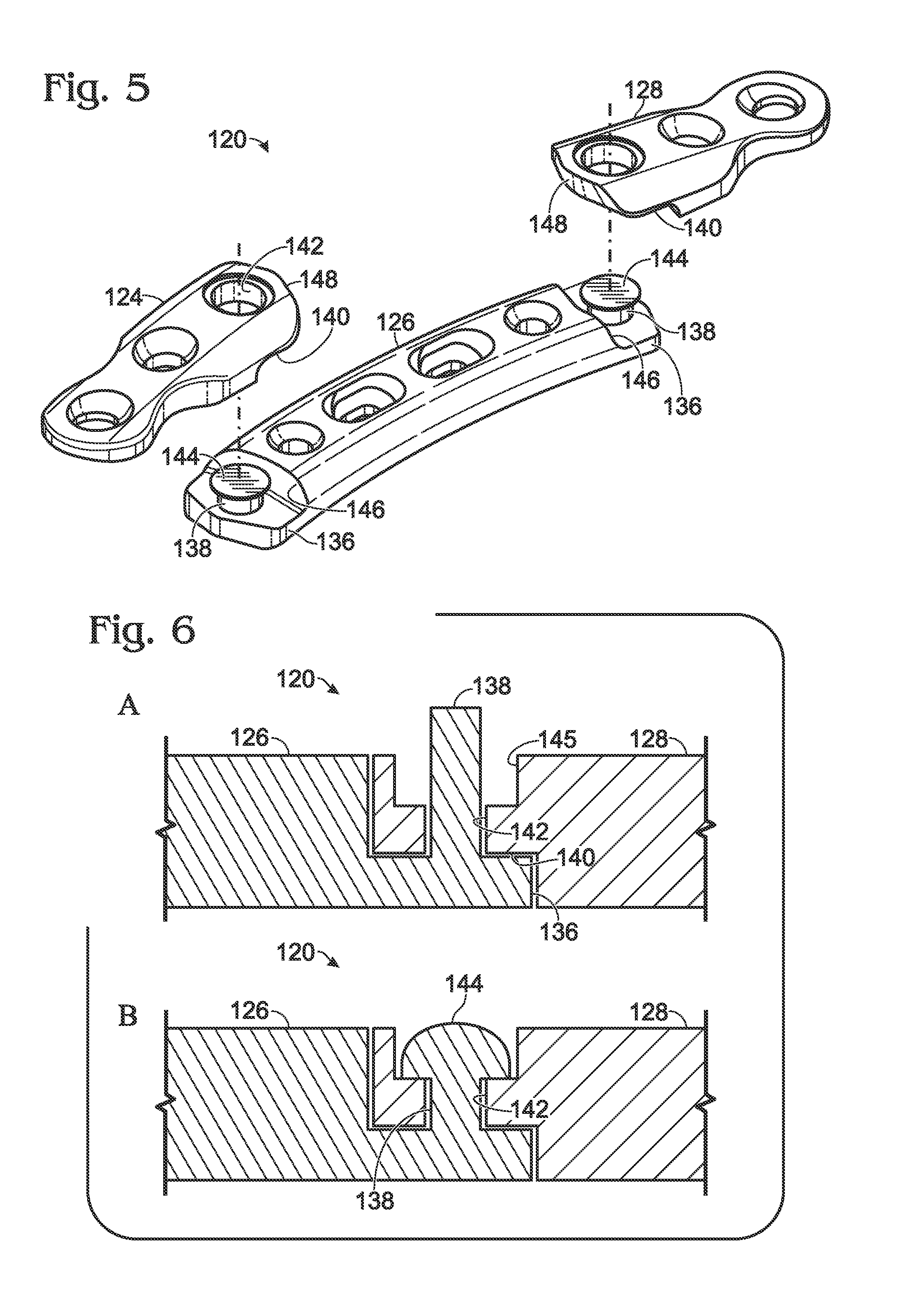 Bone plate with movable joint