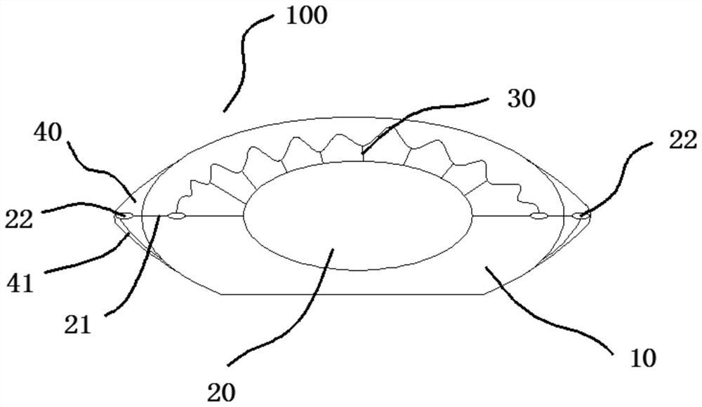 Eyeball antiseptic bandages that squeeze slow-release reagents through the eyelids