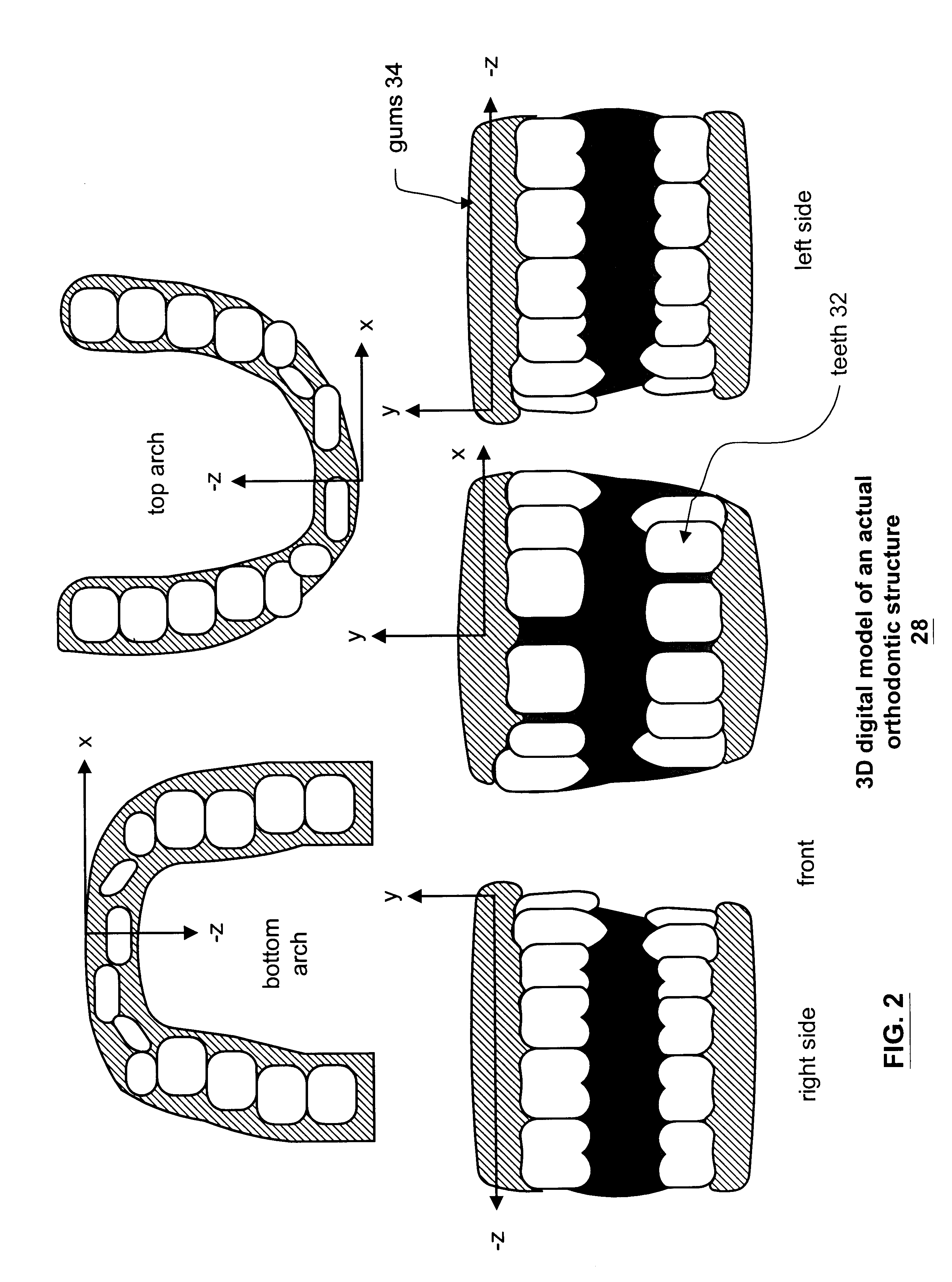 Method and apparatus for generating a desired three-dimensional digital model of an orthodontic structure
