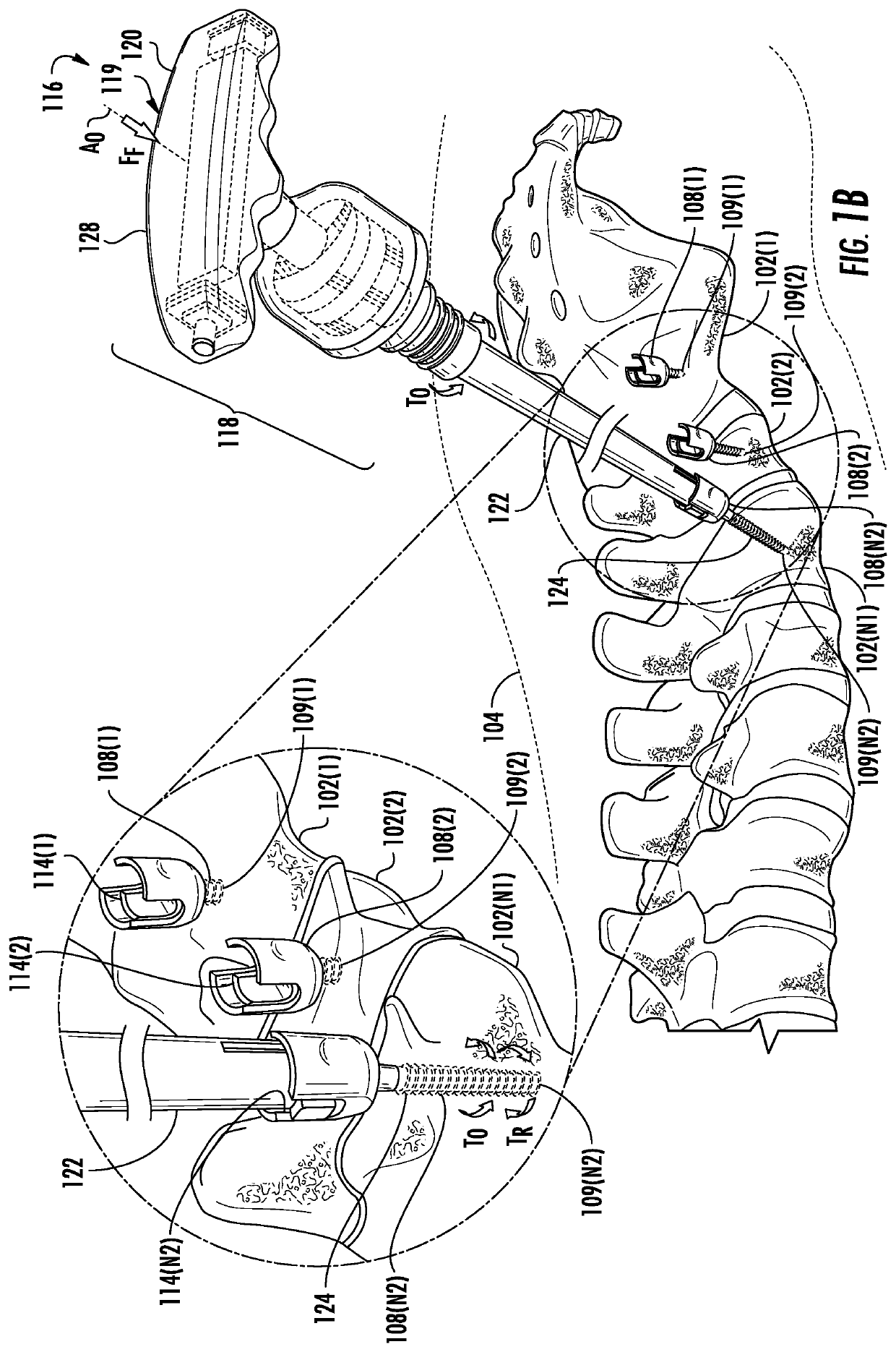 Multi-mode torque drivers employing Anti-backdrive units for managing pedicle screw attachments with vertebrae, and related systems and methods