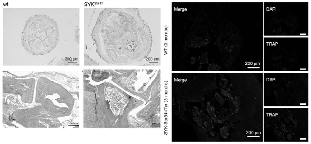 Construction method of spontaneous rheumatoid arthritis mouse model