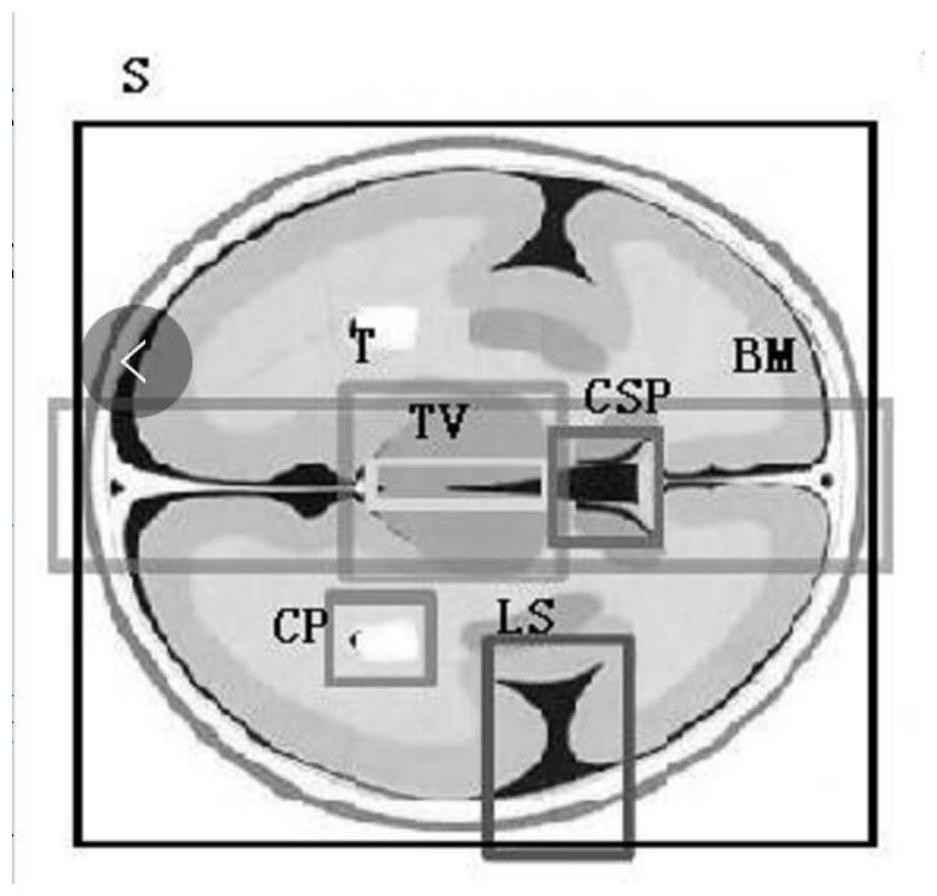 A method for quality control of ultrasound section images of fetuses in the second and third trimesters