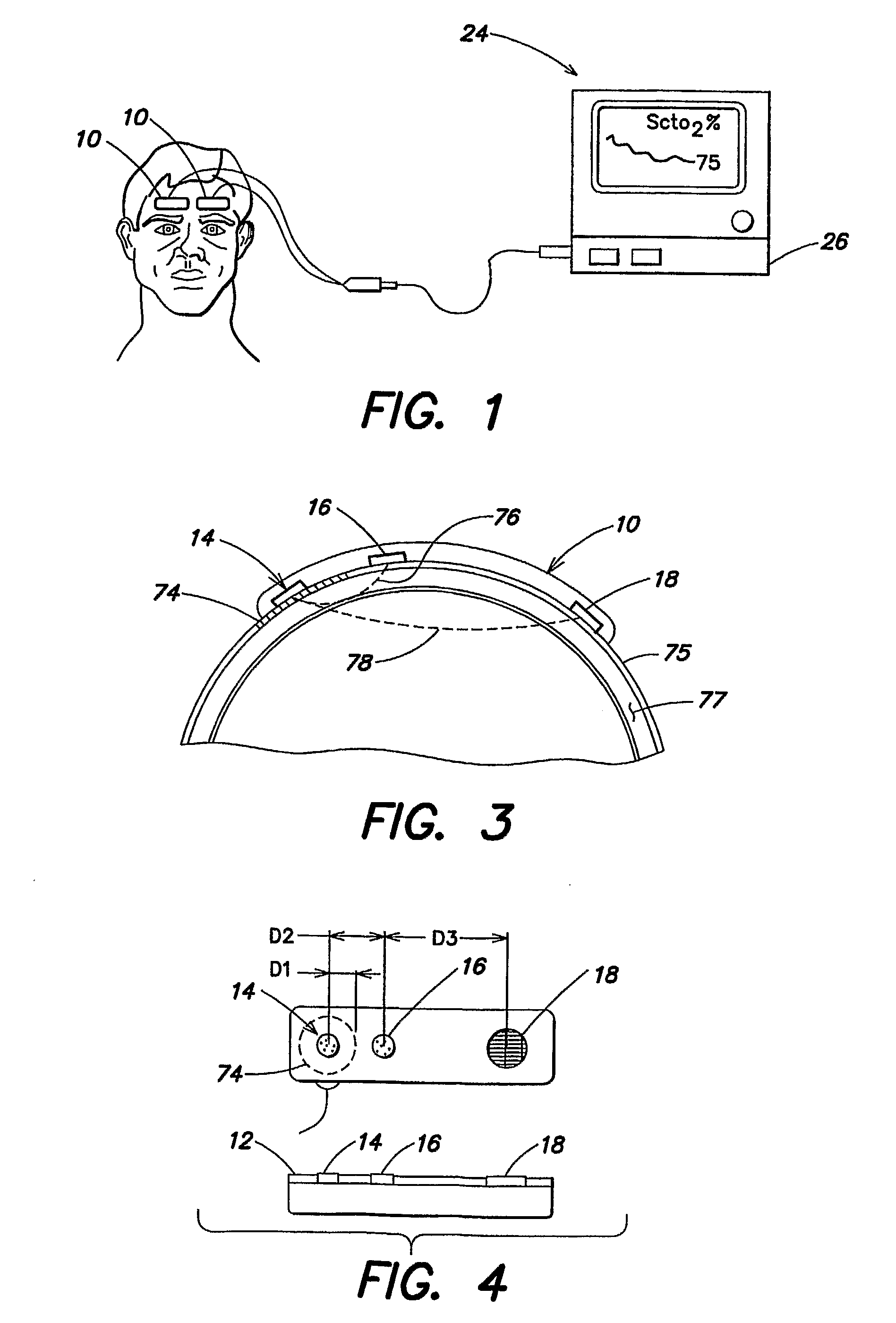 Method and apparatus for spectrophotometric based oximetry