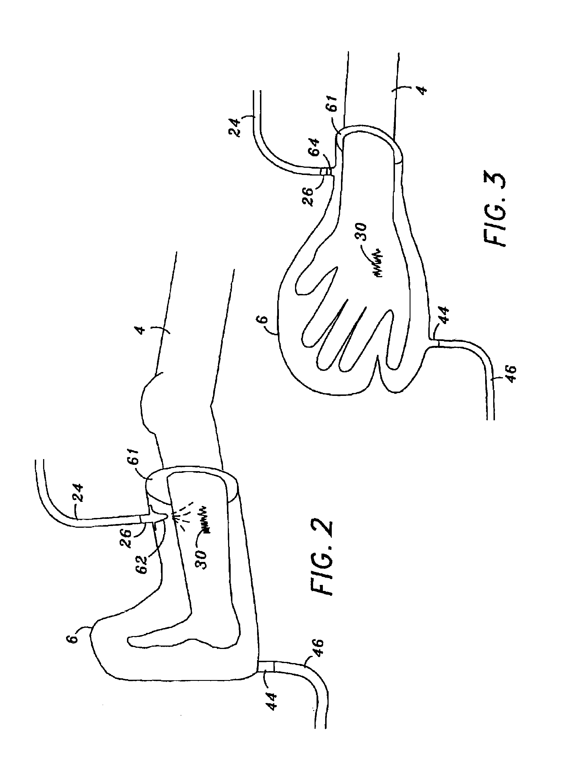 Methods of Treating An Infection with Nitric Oxide
