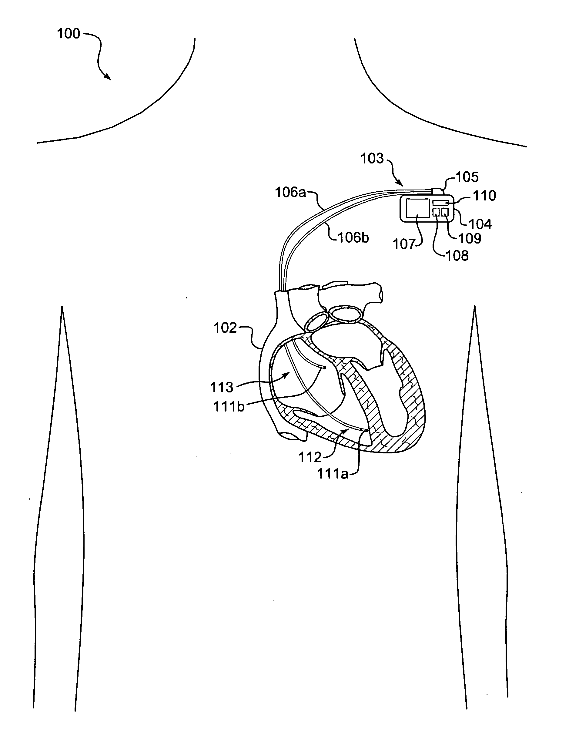 Patient management device for portably interfacing with a plurality of implantable medical devices and method thereof