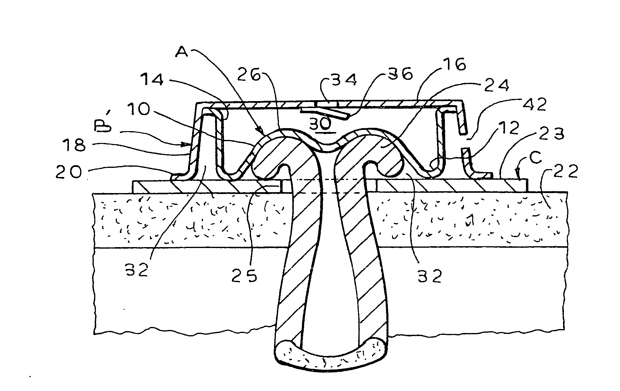 Controlled evacuation ostomy device with external seal