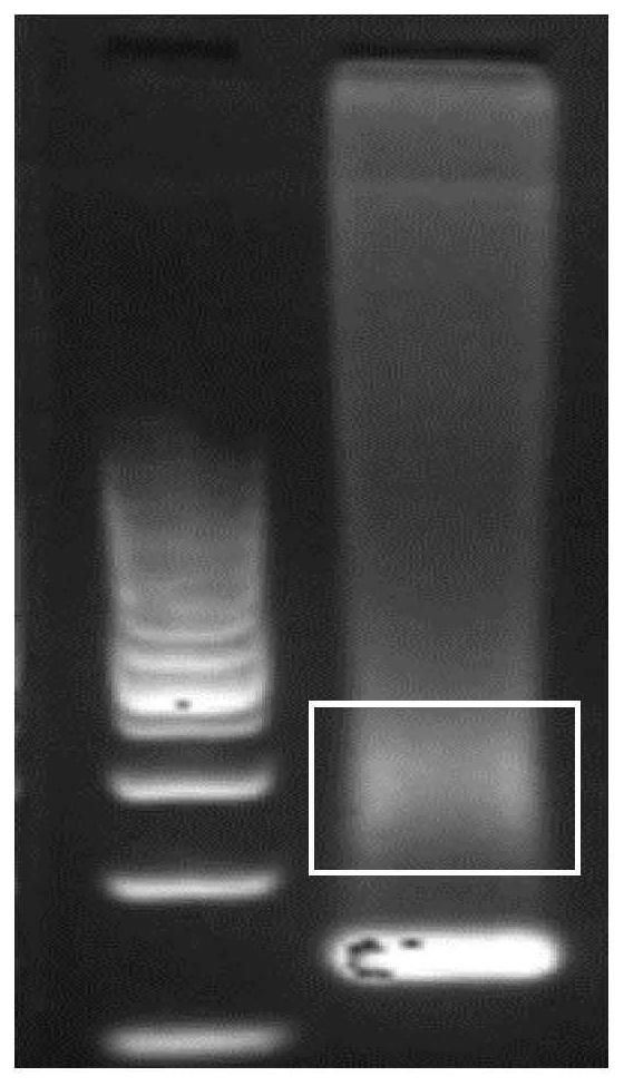 A method for extracting cfDNA from follicular fluid