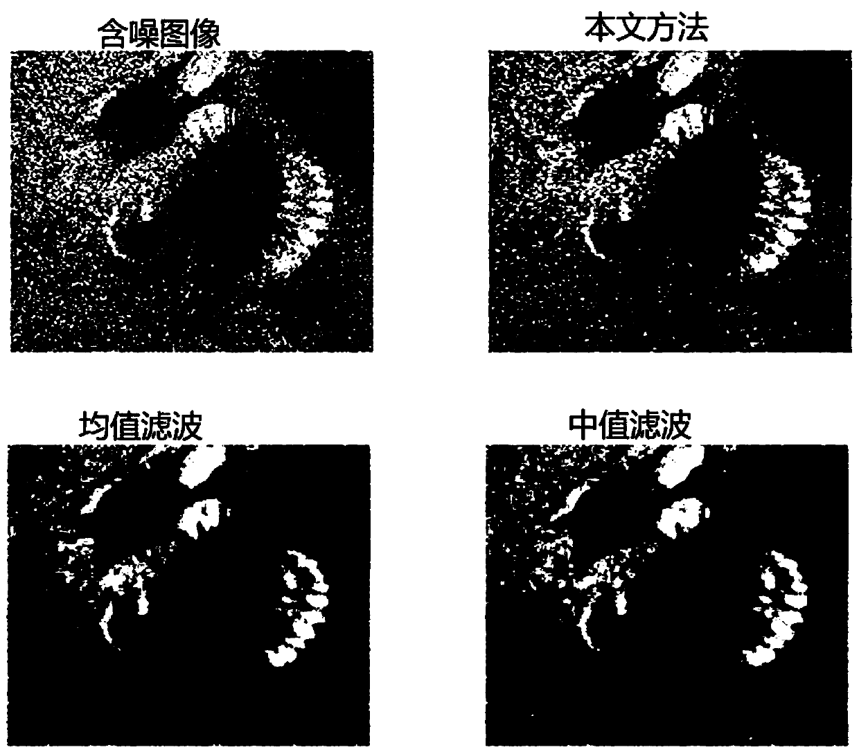 Underwater information anti-interference method based on compressed sensing and Renyi entropy