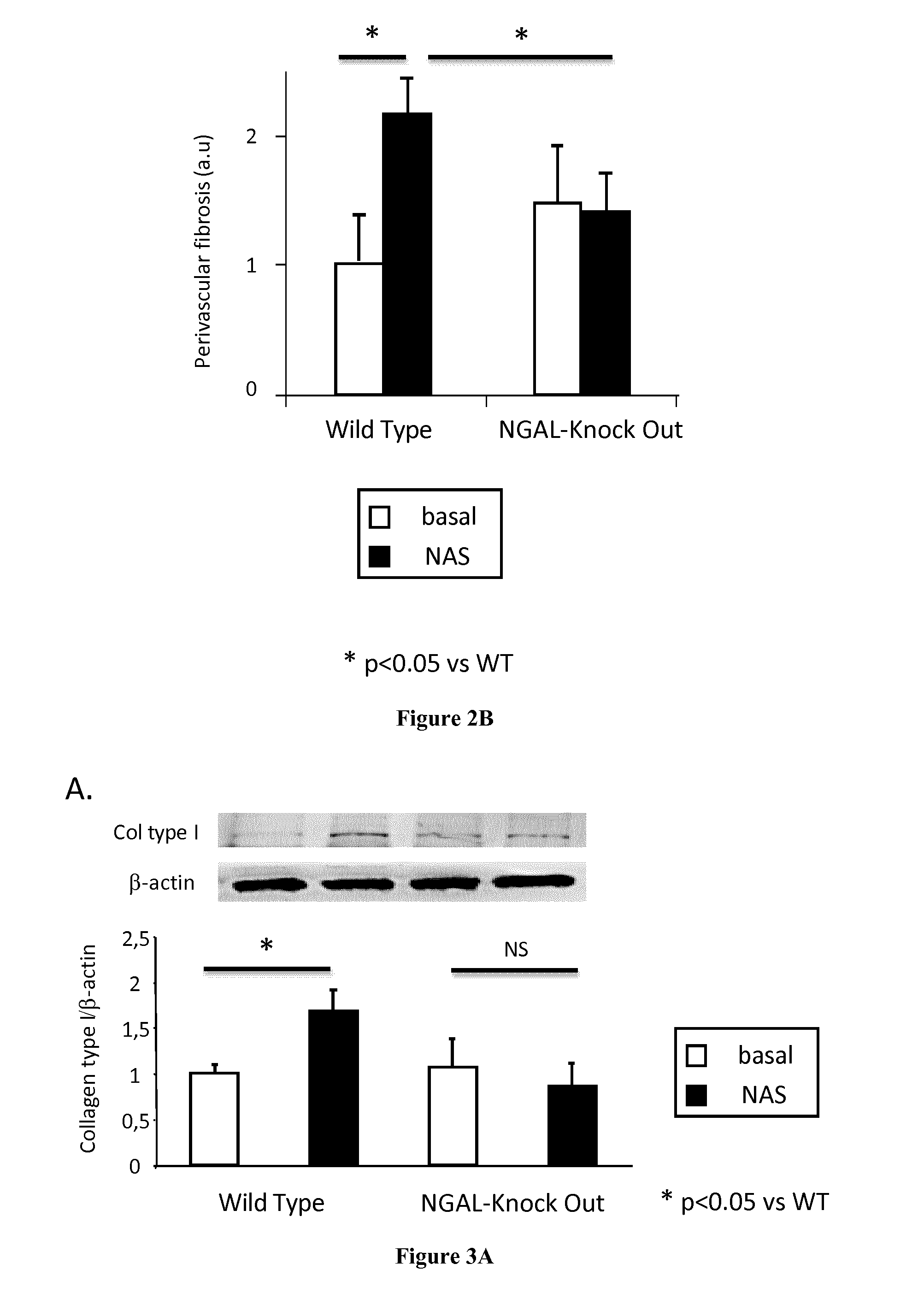 Methods and Pharmaceutical Compositions for the Treatment of Cardiovascular Fibrosis