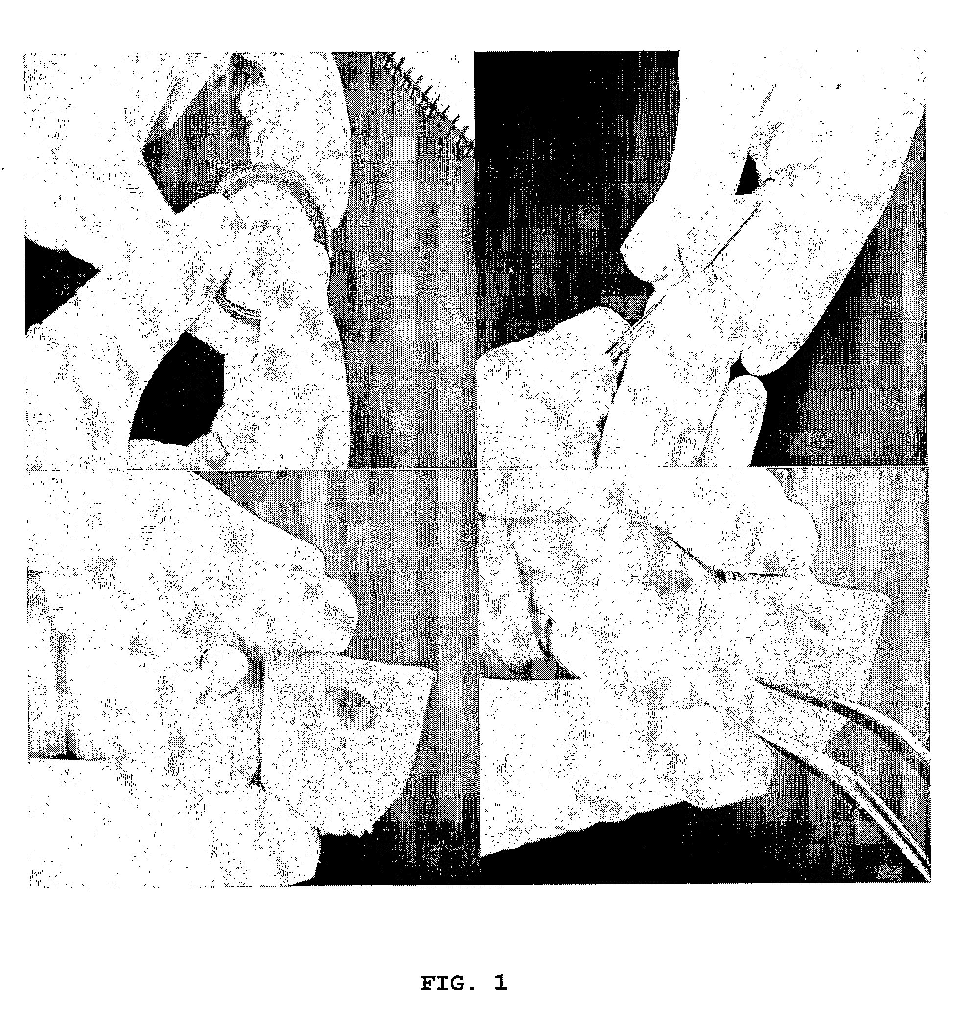 Use of Stem Cells, Method of Tissue Engineering, Use of Dental Tissues and Tooth Biological Substitute