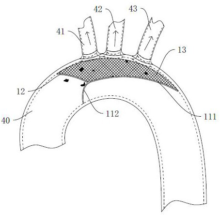 Anti-embolism protection device and medical instrument
