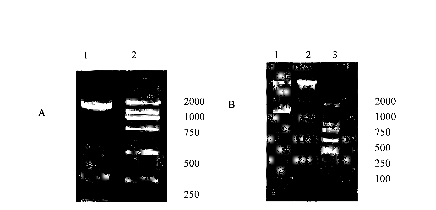 Immune fusion protein and gene encoding same and application thereof