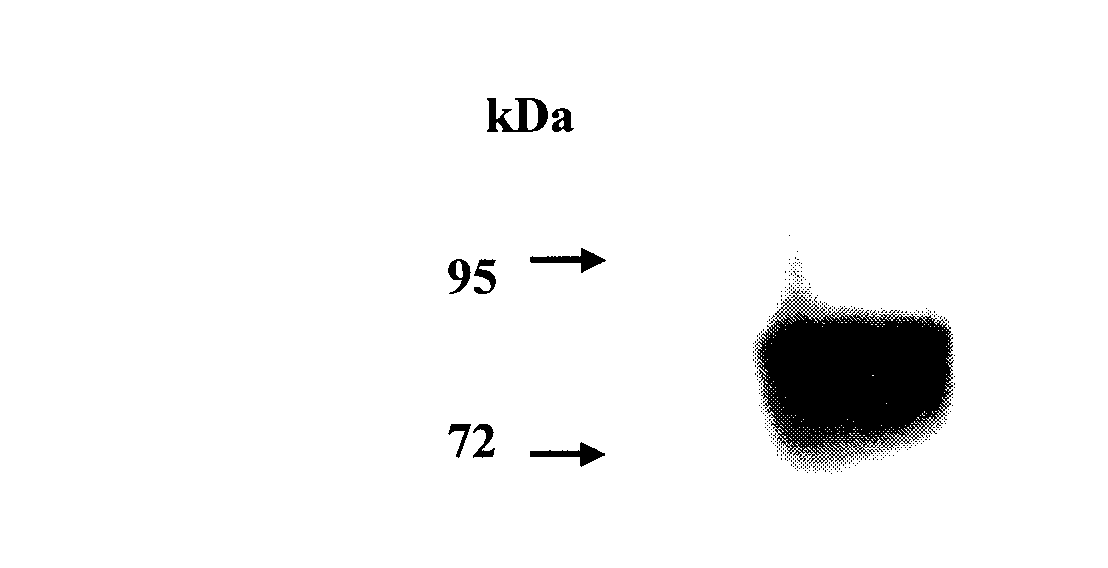 Immune fusion protein and gene encoding same and application thereof