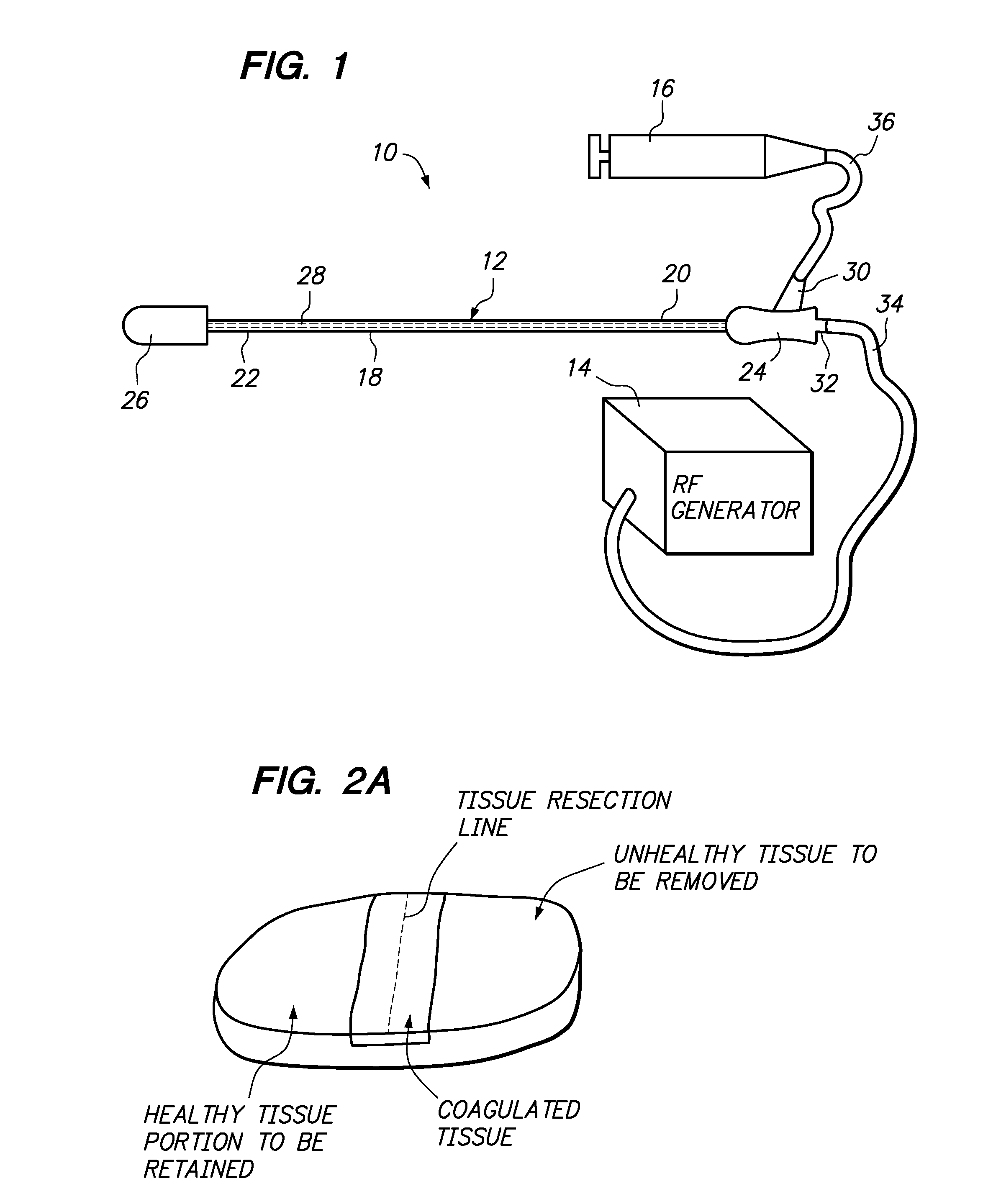 Foam electrode and method of use thereof during tissue resection