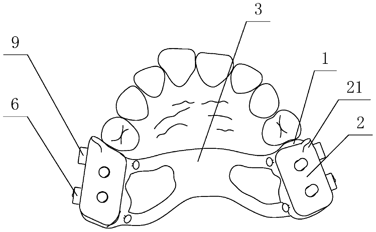 Mandible guiding forward and fixed orthodontic combined correction device