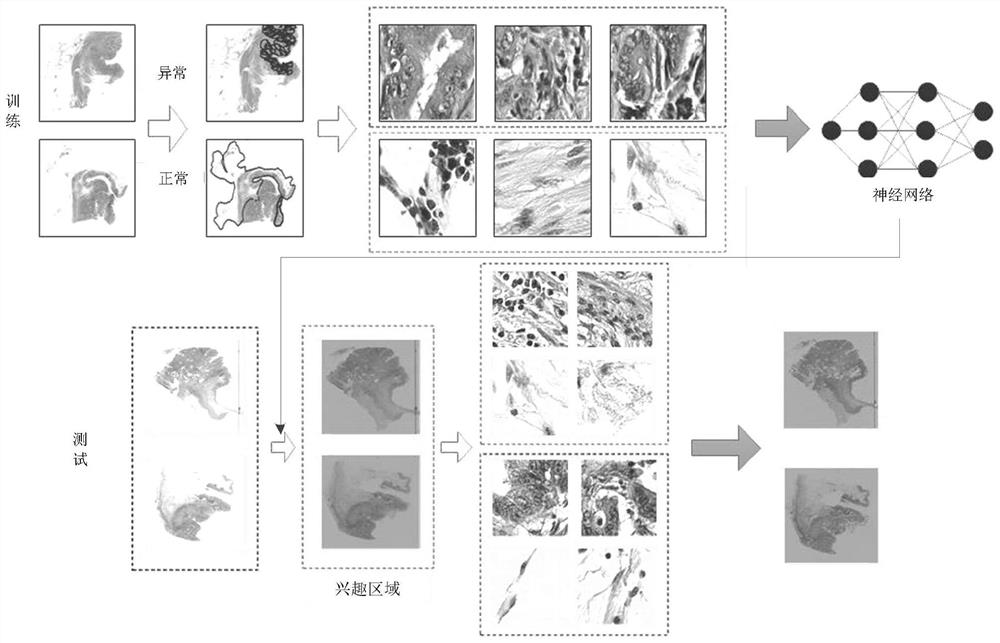DMMR subtype classification method and system based on pathological image
